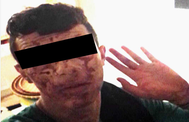 Mördaren, nedsmetad av offrets blod, fotograferade sig själv efter dådet. Foto: Polisens förundersökninsgprotokoll